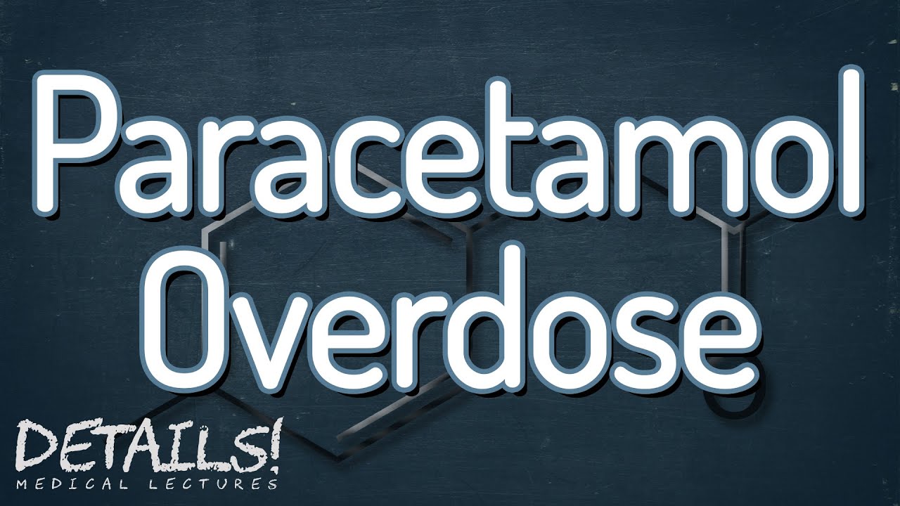 Paracetamol Overdose | Administering NAC | Details