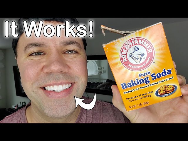 How to Whiten Teeth Safely and Naturally // How to Make Teeth More White class=