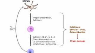 Living With Lupus Hematopoietic Stem Cell Therapy For Lupus