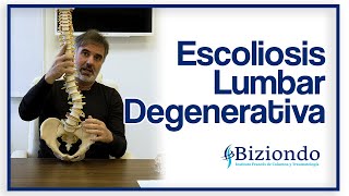 ▷ Escoliosis lumbar degenerativa: ¿Qué es?, Síntomas y tratamiento.