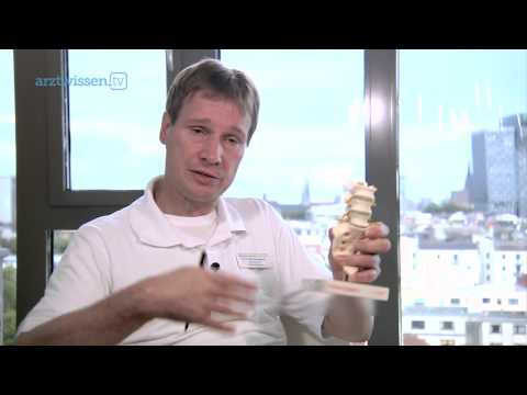 Spondylose - Was ist das und was kann man dagegen tun? ( Dr. Ralf Hempelmann)