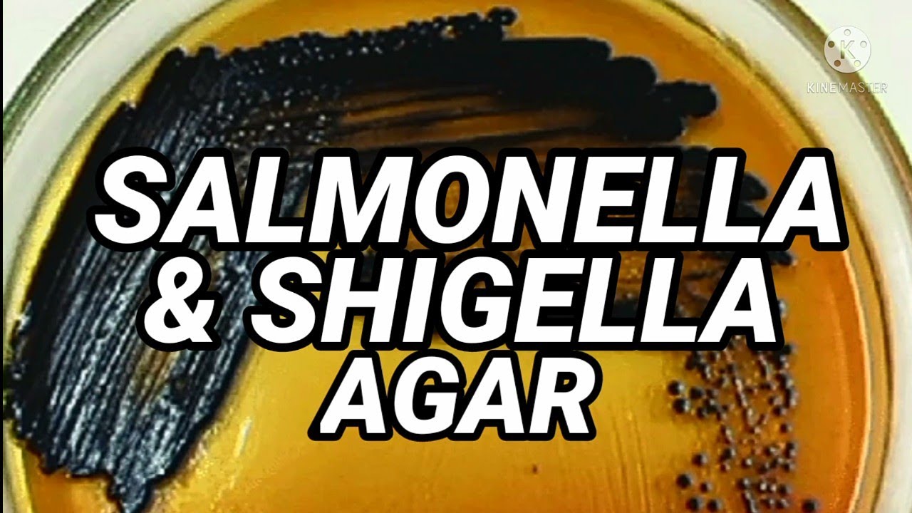 SALMONELLA & SHIGELLA AGAR | in Urdu/Hindi