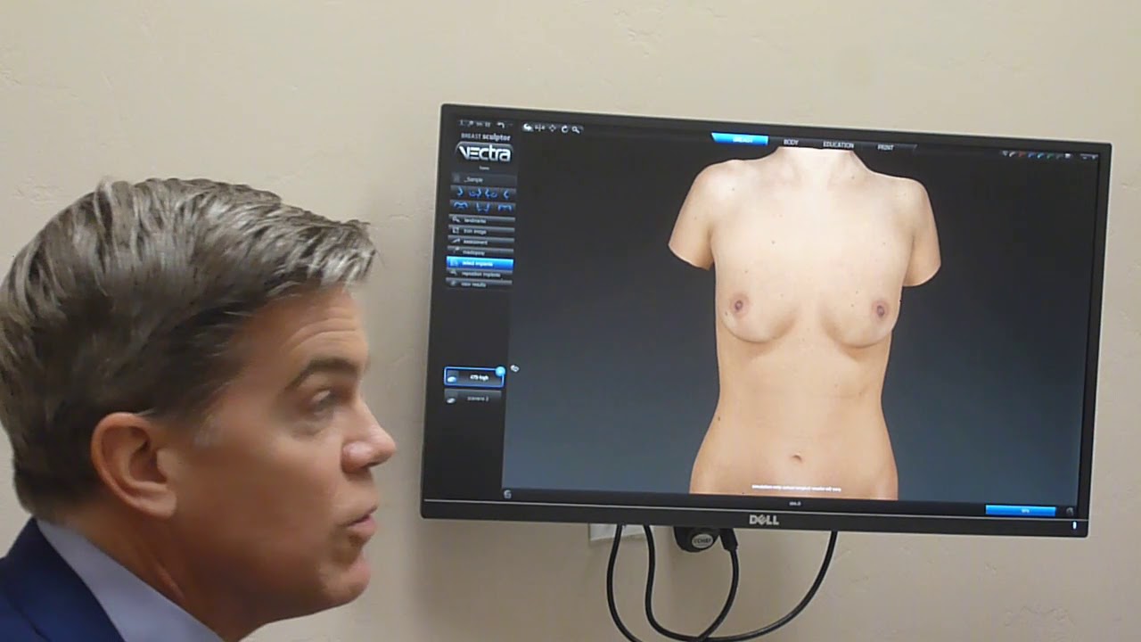 VECTRA® 3-D Imaging for Plastic Surgery in Rochester, NY