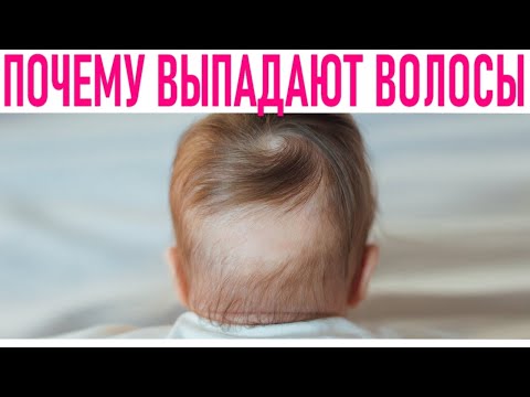 ПОЧЕМУ У НОВОРОЖДЕННОГО РЕБЕНКА ВЫПАДАЮТ ВОЛОСЫ | 5 причин выпадения волос у новорождённых детей