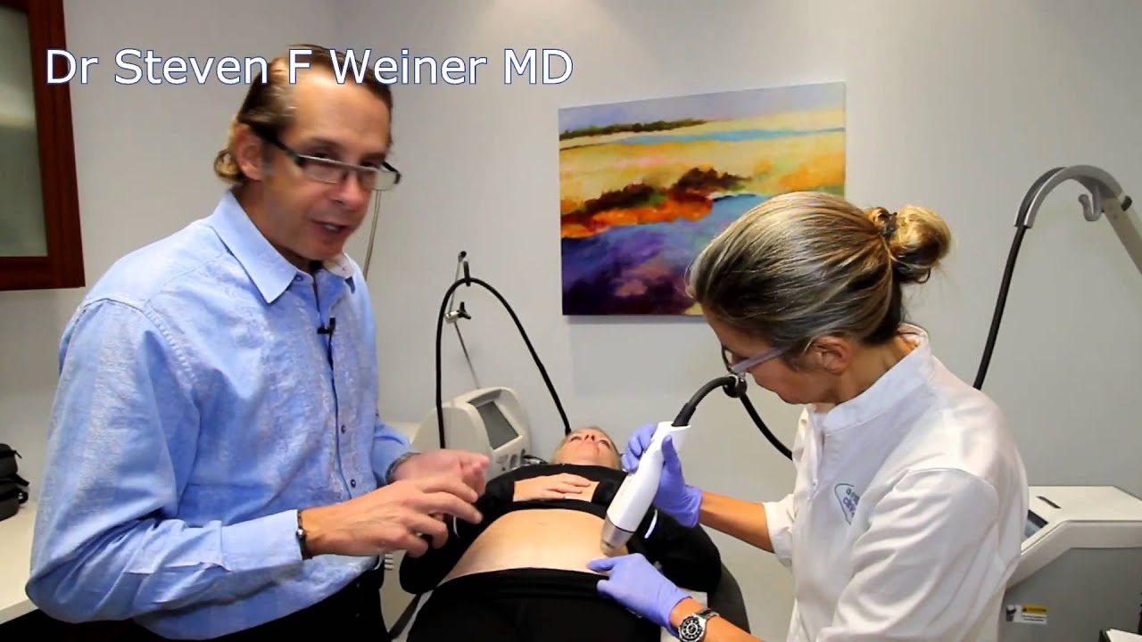 Treating Scars and Stretch Marks with the Infini, Demo by Steve Weiner, MD