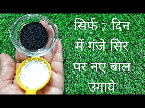 वीडियो: गंजे दिखने के 4 तरीके