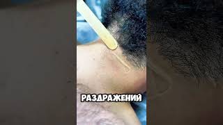 50 дней без бритья — реально? #эпиляция #ЛазернаяЭпиляция #волосы