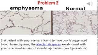 Diffusion and Osmosis problem 2 video