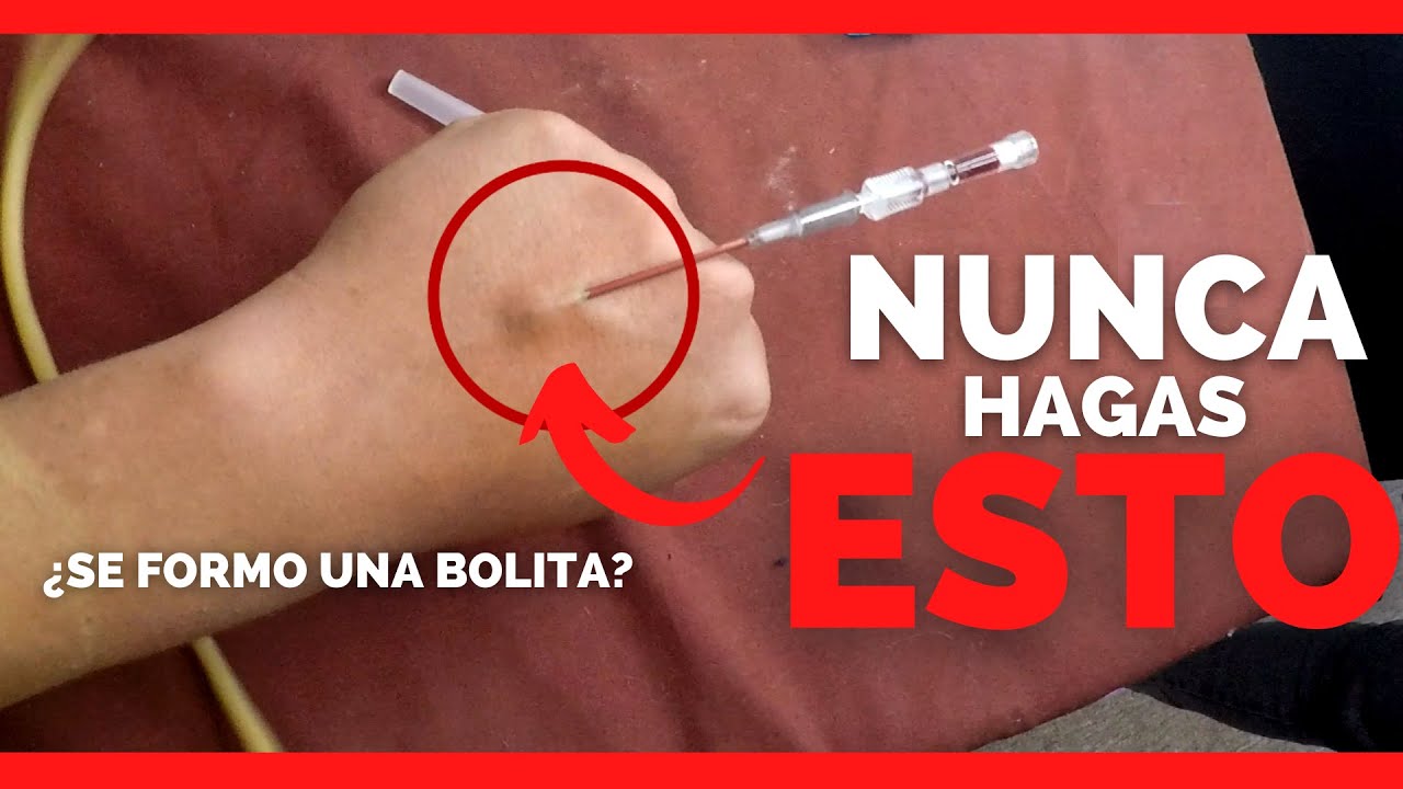 3 ERRORES que NO DEBES de COMETER al CANALIZAR 💉 | Enfermeria - YouTube