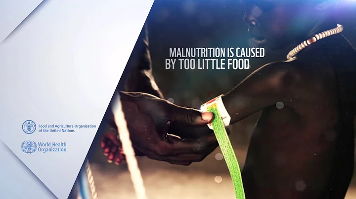 What is malnutrition? WHO FAO (en)