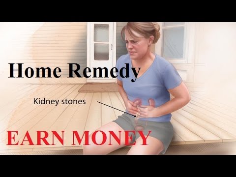 How Do Kidney Stones Form? How Can We Prevent Them? - YouTube