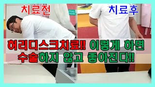 허리디스크 치료는 이렇게 하는거야~~ 라고 자랑하고 싶어서 영상올립니다. ^^ 가장 최상의 통증치료법 전기신경치료를 이용한 치료결과를 볼수 있습니다.