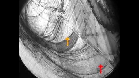 Shape memory alloy phase transition