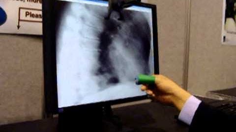 Natural User Interface for Medical Imaging Software (RSNA 2005) (3/3)