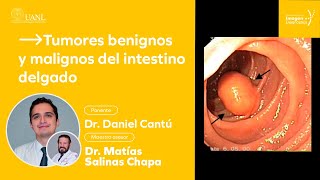 Tumores benignos y malignos del intestino delgado por el Dr. Daniel Cantú.