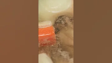 Лайфхак! Что делать если в супе мутный бульон? 🤔😎