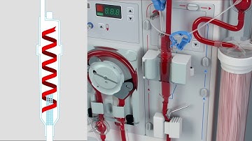 Streamline® Express Animation – Venous Vortex Chamber