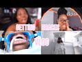 Come With Me To Get Braces!! | The Whole Process PAINFUL 🥲🤍