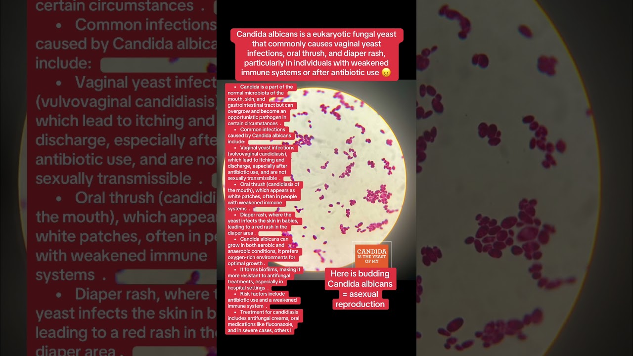 Candida albicans is a eukaryotic fungal yeast that commonly causes vaginal yeast infections