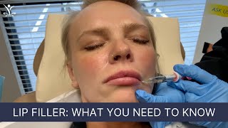 The Dos and Don'ts of Lip Filler