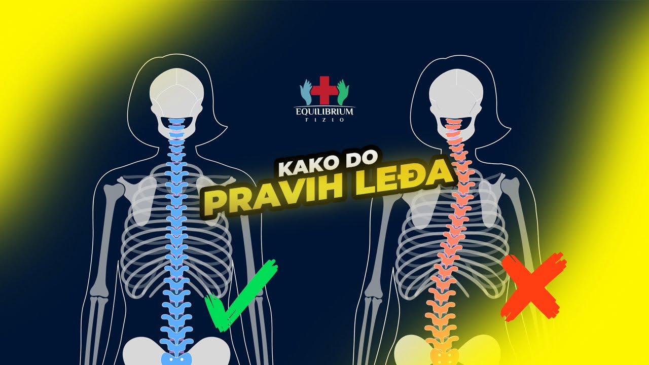 🚨 UPOZORENJE! Skolioza Kod Dece – Može Li Se Ispraviti? ⚠️