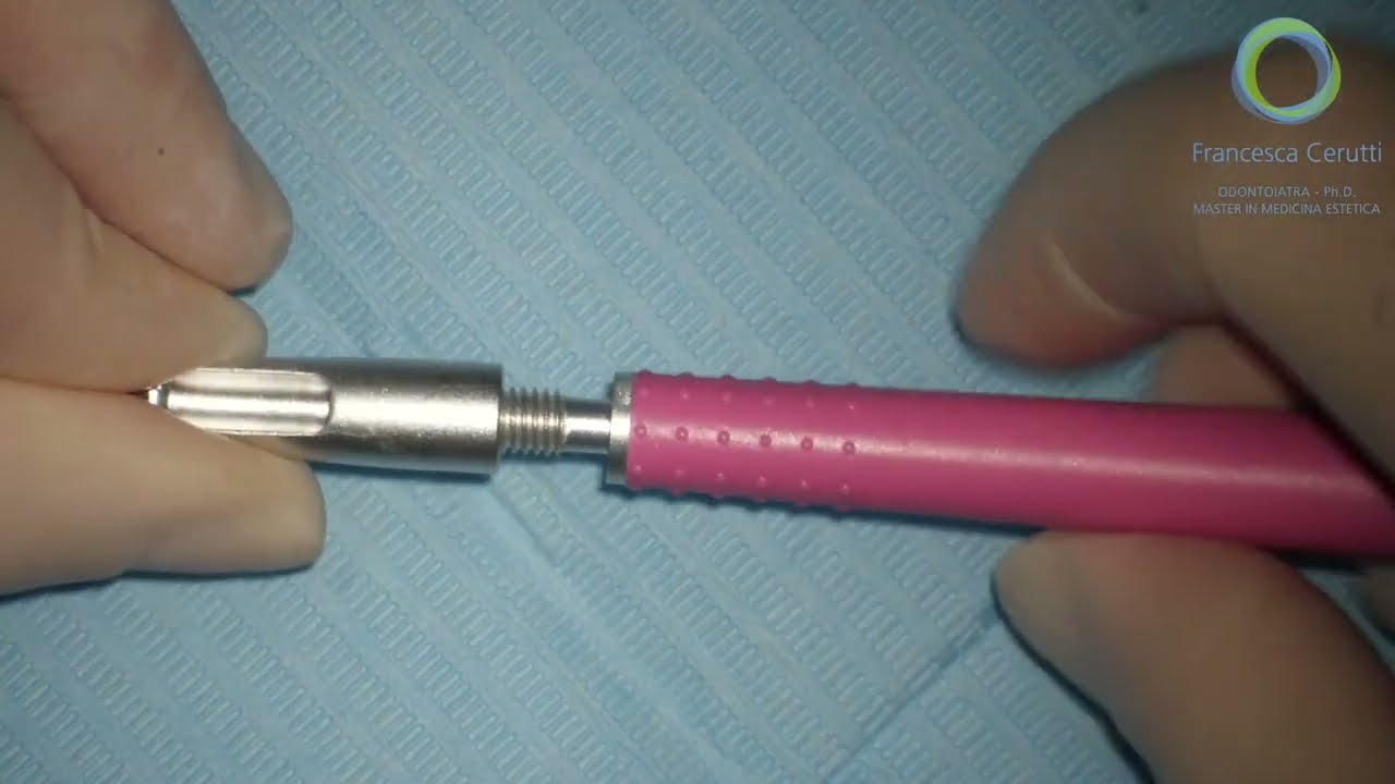 FANTA C-Handle Setup