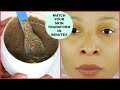 50 YEARS OLD WOMAN LOOK 30 | ANTI - AGING, REMOVE WRINKLES, TIGHTEN FIRM, CLEAR DARK SPOTS FACE MASK