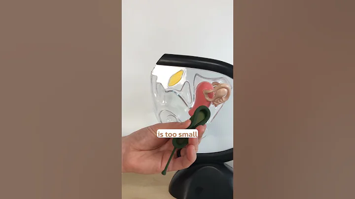 Common Mistakes with Menstrual Discs - how to fix leaks