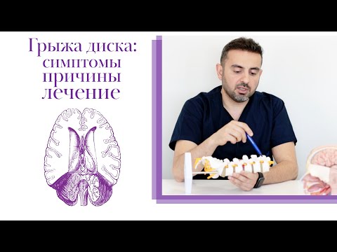 Грыжа поясничного отдела позвоночника: симптомы, причины, лечение