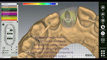 How to design a Screw Retained Crown in #exocad