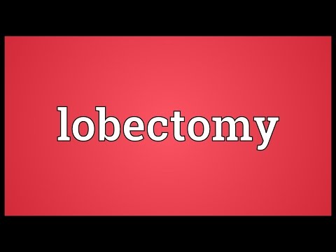 Header of lobectomy