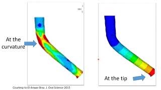Preventing Fracture of Rotary Instruments