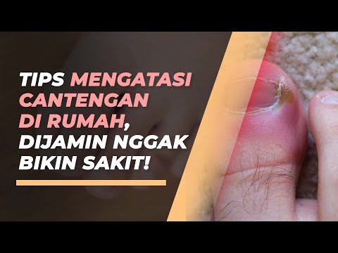 Cara Kuku Cantengan