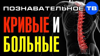 Почему люди кривые и больные? (Познавательное ТВ, Евгений Беляков)