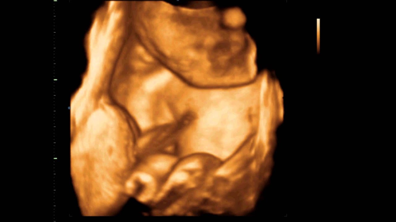 4D Ultrasound Baby Boy 28 Weeks from Sono Baby Studio - YouTube