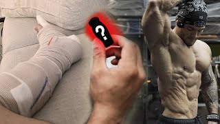 How I'm using peptides to heal my torn achilles fast