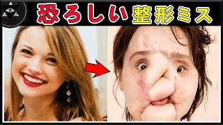 世界で最も恐ろしい10大整形ミス!医師の過ちで顔立ちが歪み、1位は人型の怪物と呼ばれて彼氏はその場で別れをつげた!