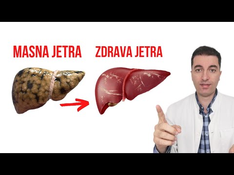 Video: Je li esencijalni premium impliciran?