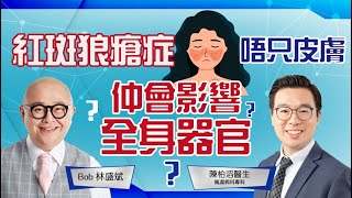 紅斑狼瘡症│蝴蝶斑疹│亞急性紅斑狼瘡│風濕病科│脫髮│攻擊全身器官│類固醇│組合治療│林盛斌 Bob (中文字幕)