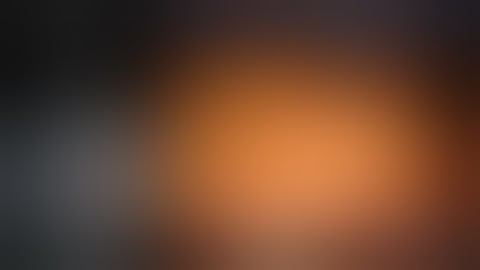 Integrated Table Motion dV Colon Resection