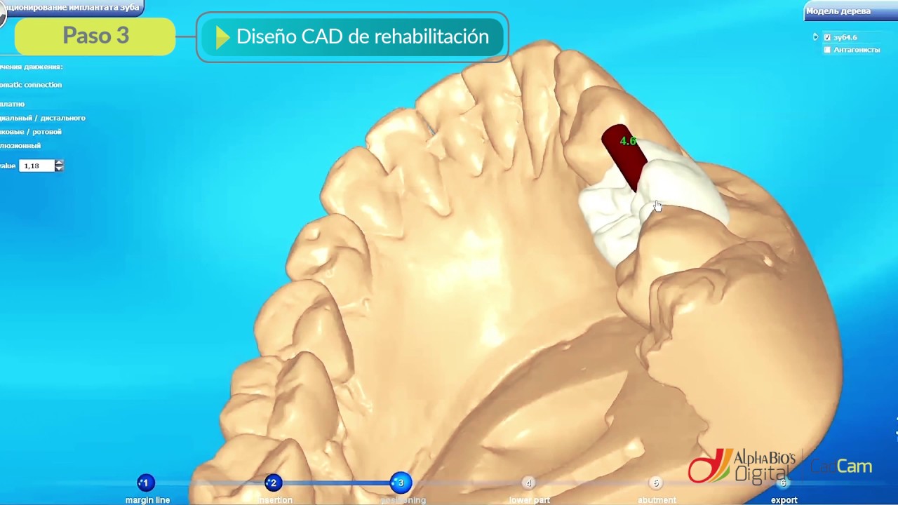 CAD CAM impresión intraoral | Alpha-Bio Tec. - YouTube
