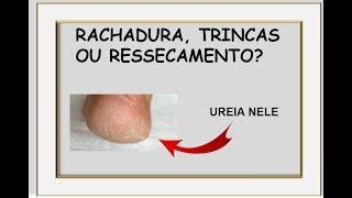 Faz pele uréia o pela que a