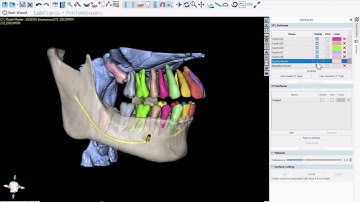 BSP V4.13: Completely Automatic AI Segmentation of Teeth, Airways, Jaws, and Nerves. Free!