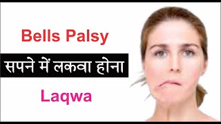 Sapne mein Bells Palsy Hone ka Arth || सपने में लकवा होने का अर्थ screenshot 3