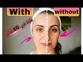 مساج لكامل الوجه شد ونفخ الوجه بدون بوتوكس وفيلر Botox Lifting Shortvideo Facemassage مساج لكامل الوجه شد ونفخ الوجه بدون بوتوكس وفيلر Botox Lifting Shortvideo Facemassage