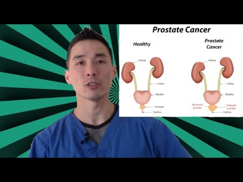 Can Frequent Ejaculations Reduce The Risk Of Prostate Cancer?