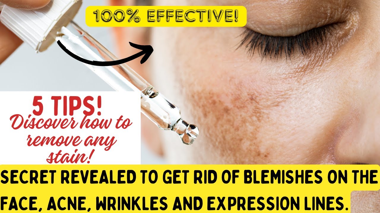 The 5 BEST WAYS to Get Rid of Wrinkles, Dark Spots and Skin MarksExpression. [SECRET REVEALED]