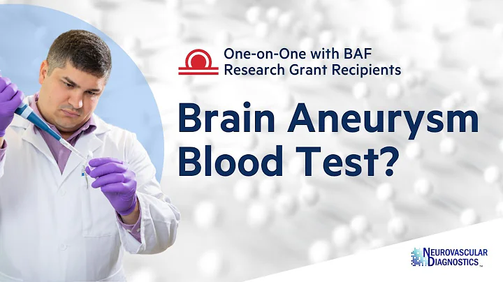 Diagnosing Brain Aneurysms with a Simple Blood Test | Vincent Tutino