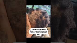 Hair Regrowth Results On My Scarring Alopecia Customer - Lichen Planopilarisccca
