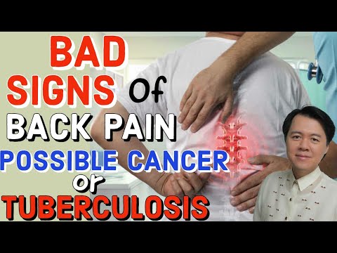 Bad Signs of Back Pain: Possible Cancer or Tuberculosis - by Dr Jeffrey Montes and Doc Willie Ong